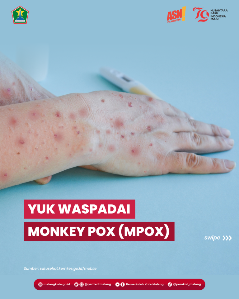 Yuk, Waspadai Virus Monkey Pox